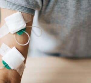 Kidney Dialysis Access in singapore