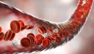 best treatment for peripheral artery disease singapore