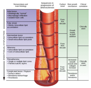 best treatment for peripheral artery disease singapore