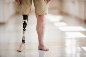 peripheral arterial disease treatment