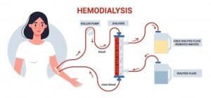 dialysis
