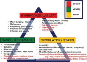 treatment for dvt singapore
