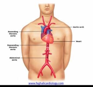 aortic aneurysm treatment singapore