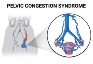 vascular disease treatment singapore