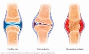 best pain management doctor in singapore