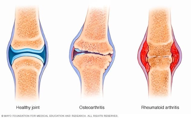 best pain management doctor in singapore
