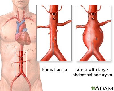 vascular disease treatment singapore
