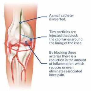 best pain management doctor in singapore