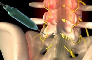 best pain management doctor in singapore