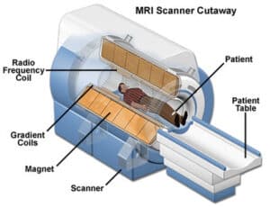 arteriovenous malformation s treatment singapore